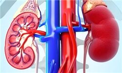 ارتباط چاقی با بیماری های کلیوی
