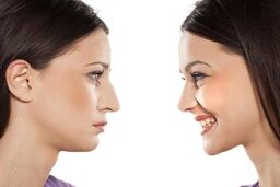  جراحی زیبایی به گردشگری پزشکی برای ایران تبدیل شده است