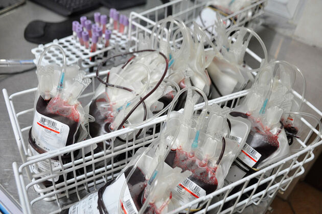 کاهش چشمگیر ضایعات فرآورده‌های خونی در استان اردبیل