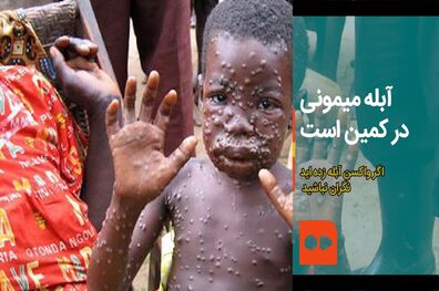 آبله میمون به مراکش هم رسید