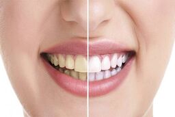 در روز چند بار مسواک بزنیم؟
