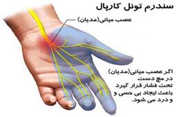 چه عواملی موجب تشدید "سندرم تونل کارپ" می‌شود؟