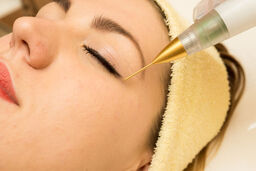 هشدار انجمن متخصصین پوست نسبت به غیر علمی بودن پلاسما درمانی