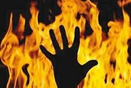  ۱۰۸ نفر به دلیل سوختگی در چهار ماهه امسال فوت کردند
