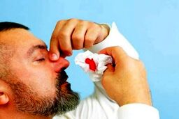 چند توصیه مهم در خصوص خونریزی بینی

