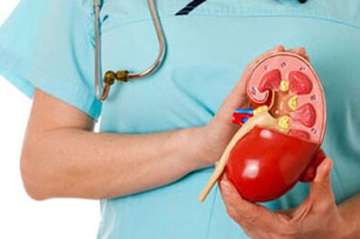 چه کار کنیم سنگ کلیه نگیریم؟