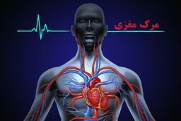 سالانه حدود 5 هزار مرگ مغزی در کشور رخ می دهد
