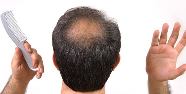 چند  ماده غذایی تقویت کننده مو را بشناسید 