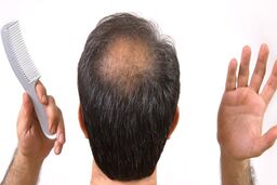 چند  ماده غذایی تقویت کننده مو را بشناسید 